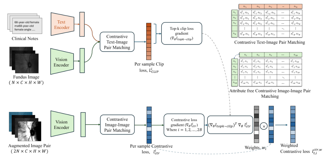 Framework diagram. Top branch: clinical notes and fundus images pass through text and vision encoders into contrastive text-image matching, giving per-sample CLIP losses and a top-k CLIP loss gradient. Bottom branch: augmented image pairs pass through the vision encoder into contrastive image-image matching, giving per-sample contrastive losses and their gradients. The dot product of the two gradients gives weights that scale the contrastive loss.